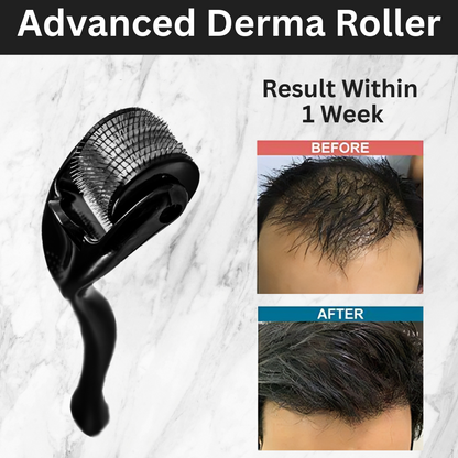 HairGrow Pro – Advanced Derma Roller